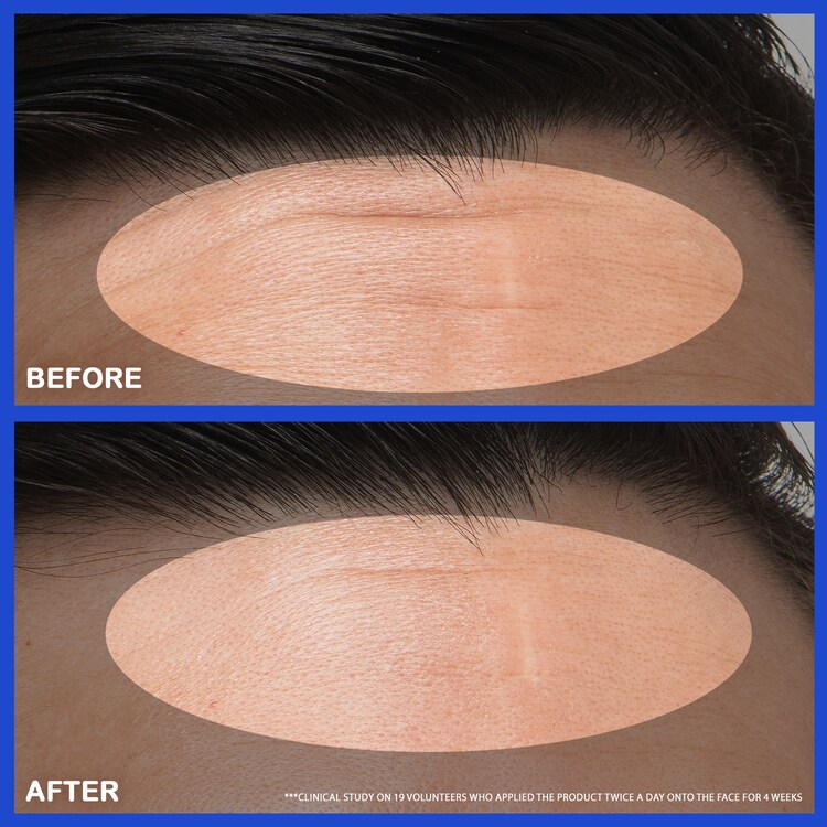 Retinol Green Tea PDRN™ Firming Serumt - Sérum alisador