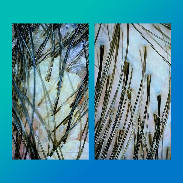 PEPTIDE PREP Detox Shampoo - Shampoing Non-Décolorant