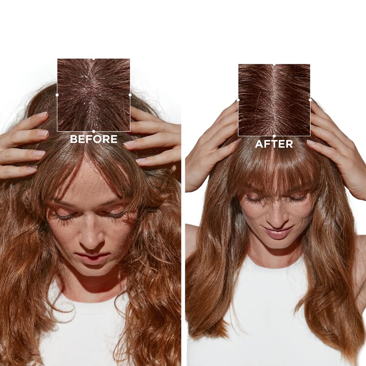 Symbiose Champú Anticaspa Hidratante Celular - Champú hidratante