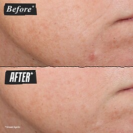 Retinol Micro-Dose Treatment - Serum