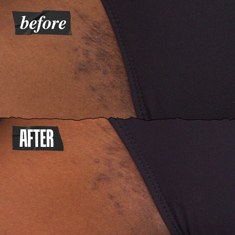 Personals Ingrown Hair & Tone Correcting Intimate Drops  - Gotas 