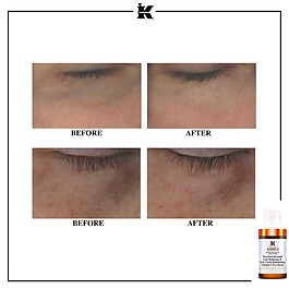 Kiehl´s Powerful Strength - Contorno de olhos com Vitamina C