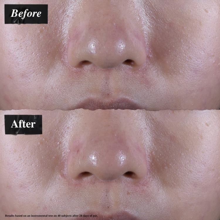 Gel Crème Hydratante pour peaux grasses - Ultra Facial Oil-Free Gel Cream