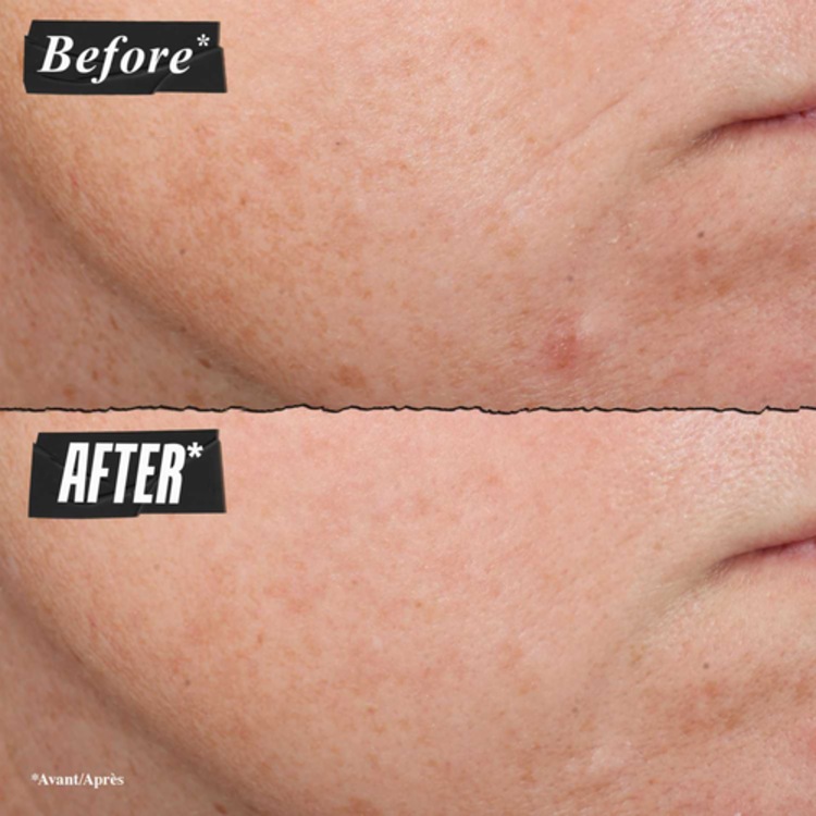 Sérum anti-âge au Rétinol Pur Micro-Dosé - Retinol Daily Micro-Dose Serum