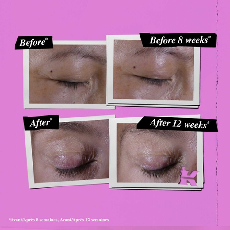 Crème Yeux correctrice aux Peptides de Collagène - Super Multi-Corrective Eye