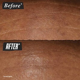 Retinol Fast Release - Sérum de noche antiedad con retinol