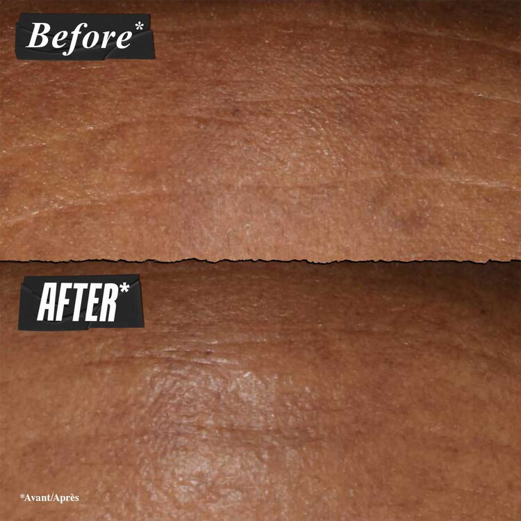 Retinol Fast Release - Sérum de noche antiedad con retinol