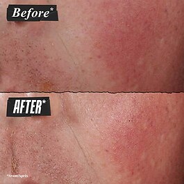 ULTRA FACIAL ADVANCED REPAIR BARRIER CREAM - Balm