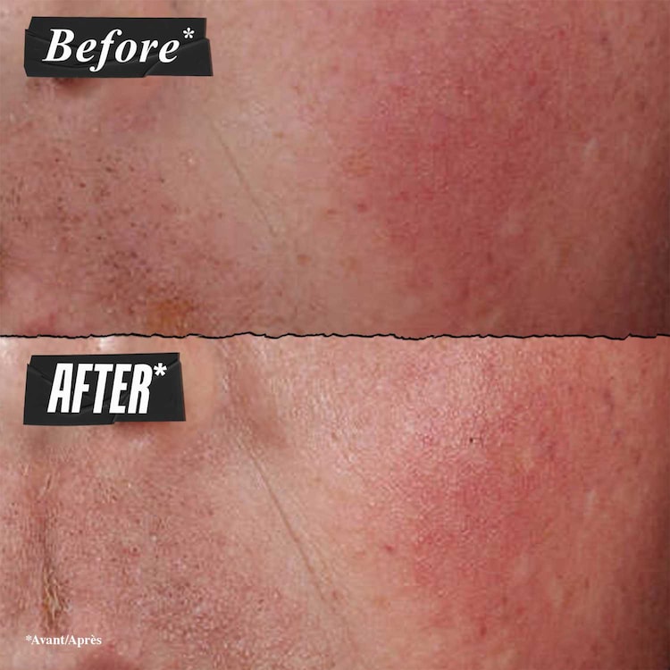 ULTRA FACIAL ADVANCED REPAIR BARRIER CREAM - Balm