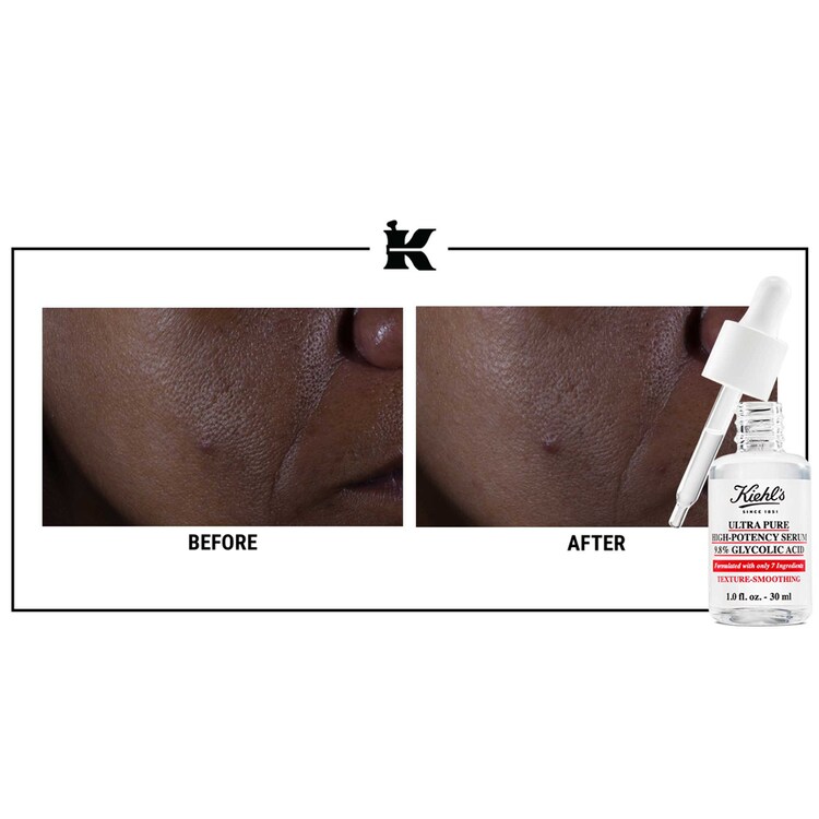 Sérum Ultra Pure - Sérum Visage à L'Acide Glycolique