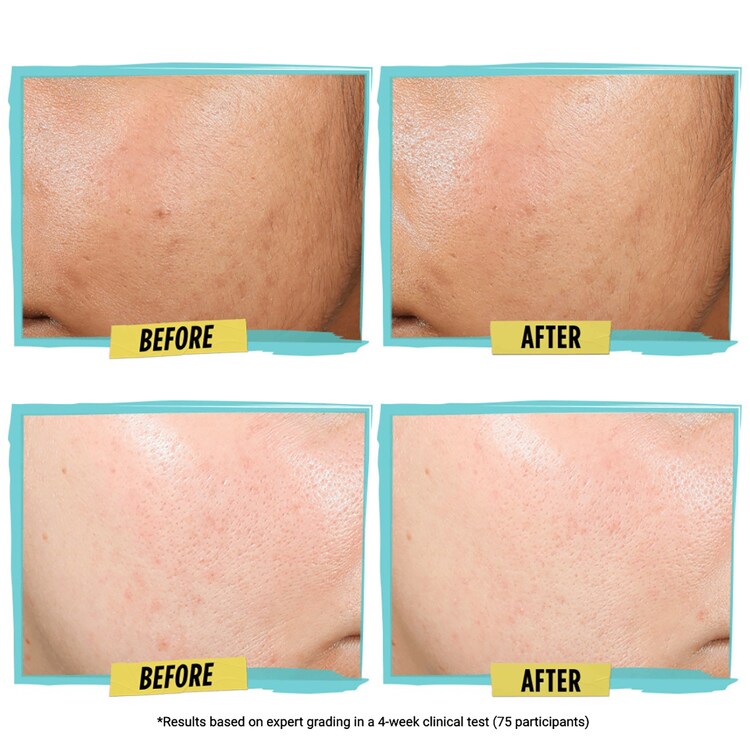 Expertly Clear Blemish-Treating & Preventing Lotion - Anti-imperfezioni