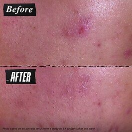 Dermatologist Solutions - Pâte Anti-Imperfections 3-en-1