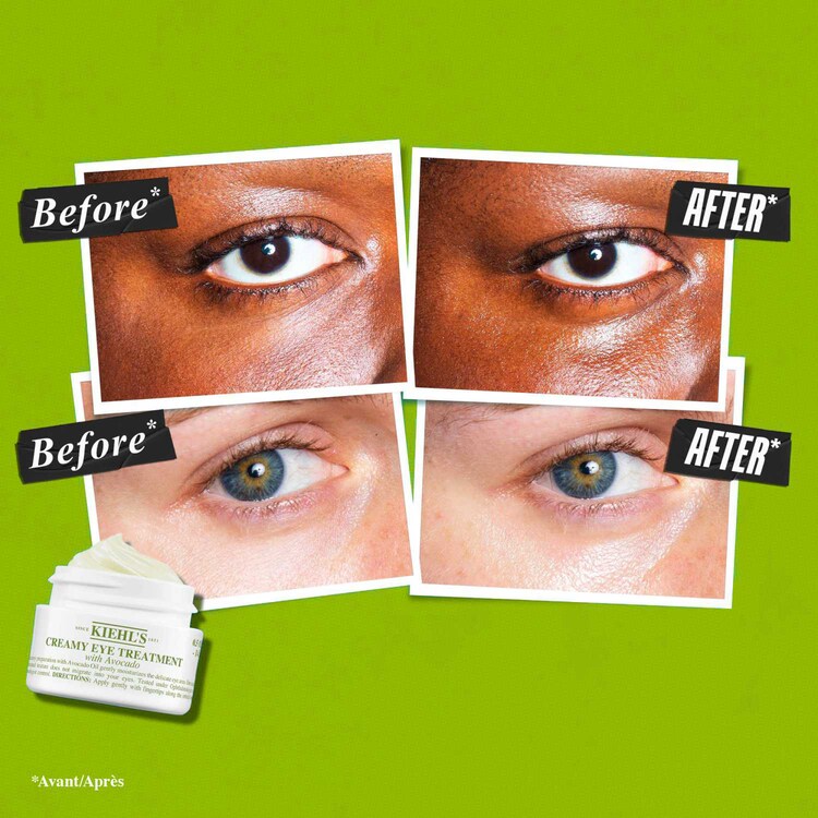 Creamy Eye Treatment with Avocado - Crema Contorno de Ojos Hidratante 