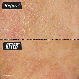 Ultra Facial - Cream