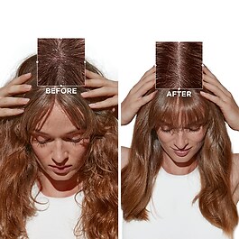 Symbiose Bain Crème Anti-Pelliculaire - shampoo per cuoio capelluto sensibile