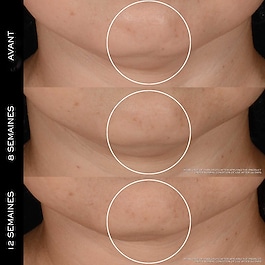 R&eacute;nergie H.P.N. Set Crema 300-Peptidi - Cofanetto