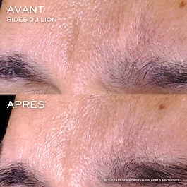 Renergie Triple Serum Night - Serum