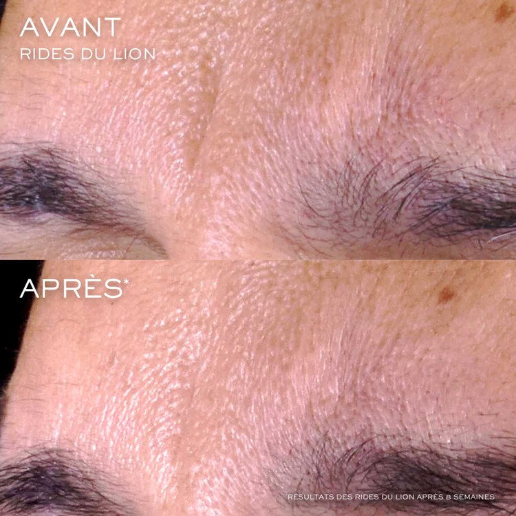 Renergie CRX Triple - Serum Night