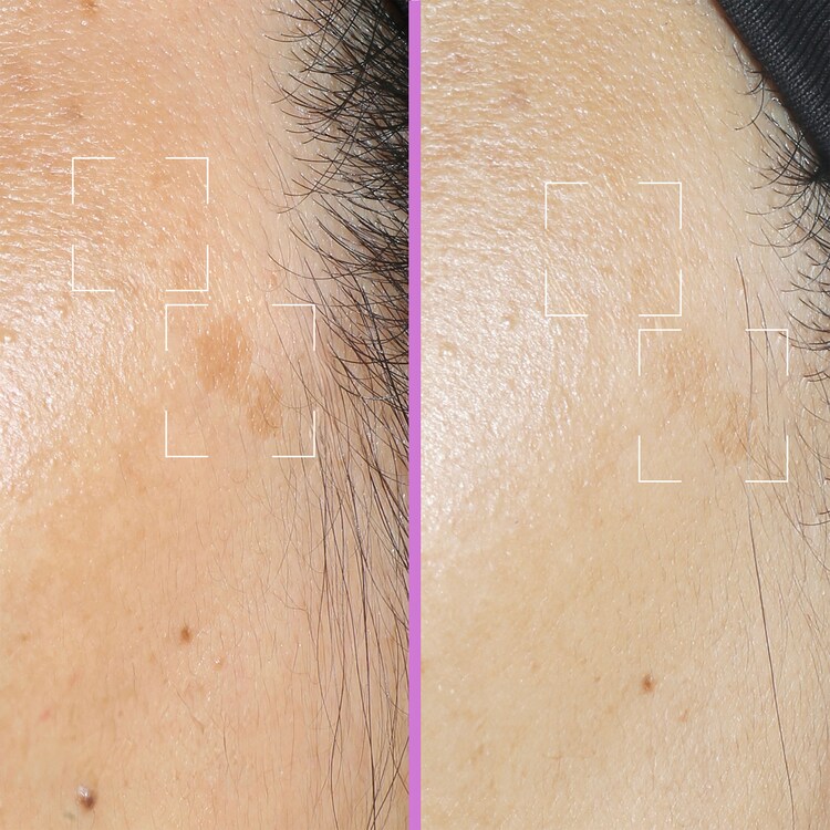 Capsule Spotless - Siero anti-macchie con niacinamide, vitamina C e HA