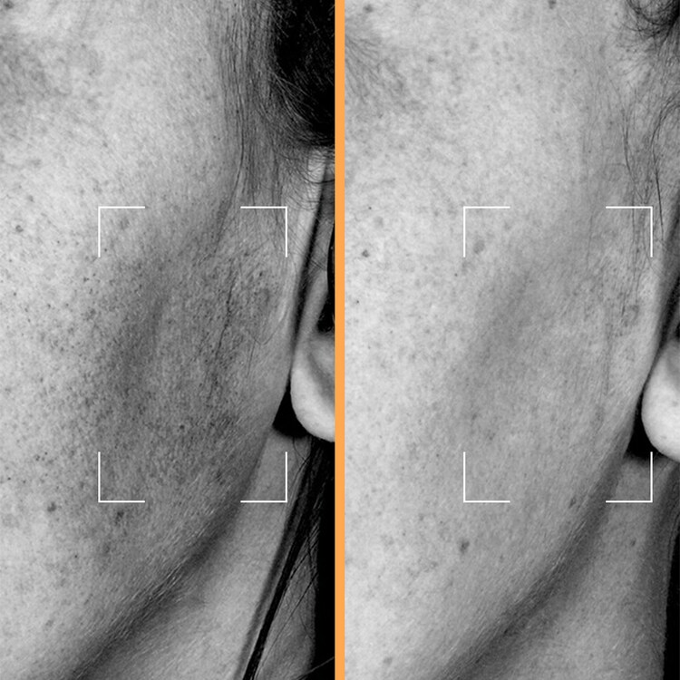 Cápsulas Brightening - Sérum glow con Niacinamida, Andrographis y Vit. C