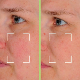 Capsules Skin Perfect - Sérum perfecteur enrichi en Niacinamide, HA et Vit. C