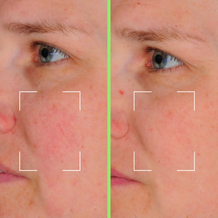 Capsules Skin Perfect - Sérum Perfecteur Hydratant à la Niacinamide & AH