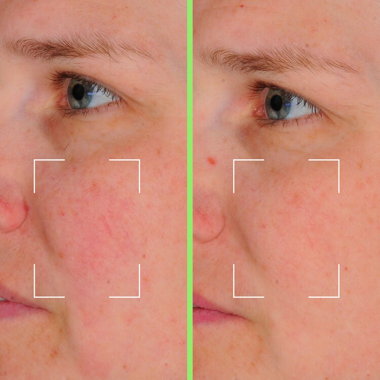 Capsules Skin Perfect - Sérum Perfecteur Hydratant à la Niacinamide & AH