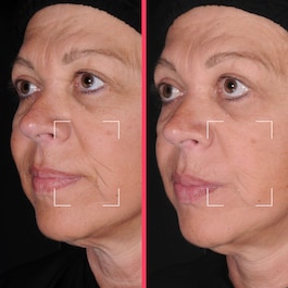 Capsules Lift - S&eacute;rum Liftant Anti-&Acirc;ge &agrave; la Niacinamide, Peptides & HA