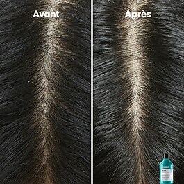 Serie Expert Scalp Advanced - Champ&uacute; anticaspa dermoclarificante