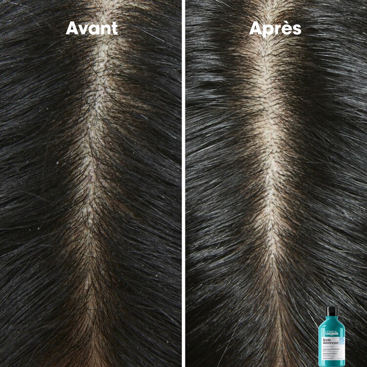 Serie Expert Scalp Advanced - Champú anticaspa dermoclarificante