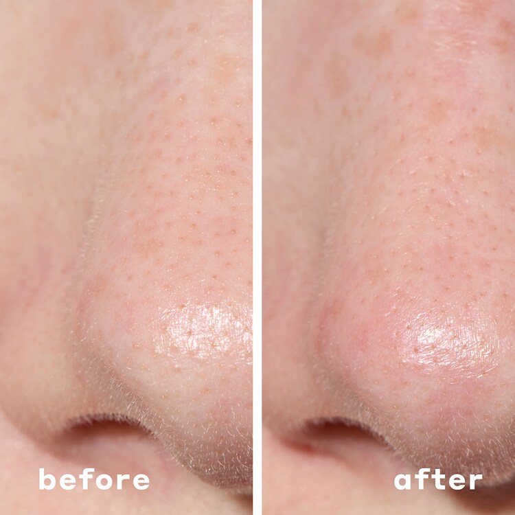 2-IN-1 DEEP CLEANSING PORE STRIP - Desobstruye los poros