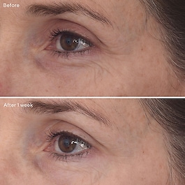 Retinal ReSculpt Eye Treatment - Przeciwstarzeniowa kuracja do okolic oczu
