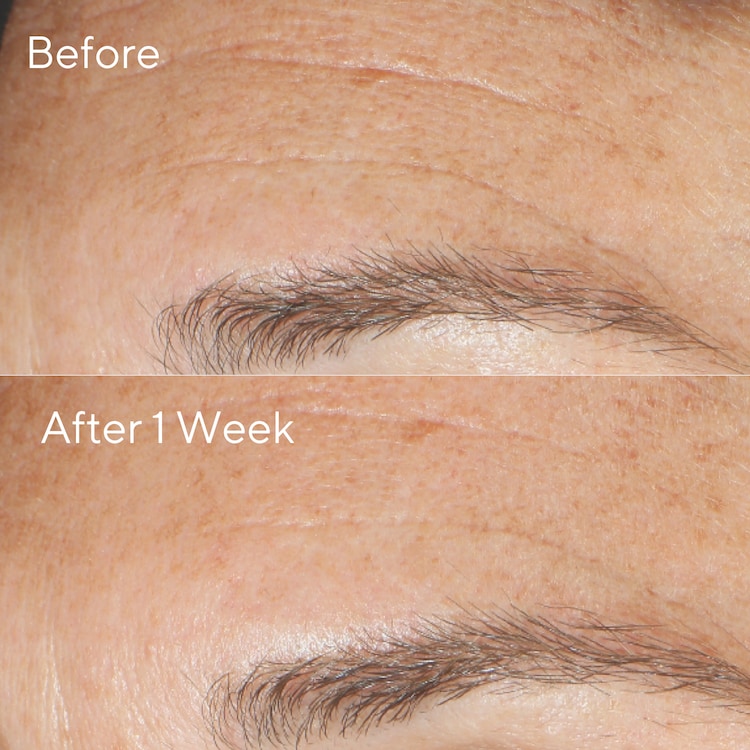 Resurgence - Peeling multi-acides revitalisant