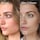 InvisiScar Resurfacing Treatment - Kuracja na blizny potrądzikowe