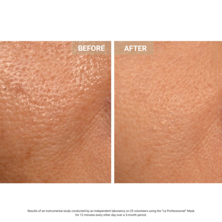 Aurion X252 LED Face Mask  - Masque LED anti-âge visage