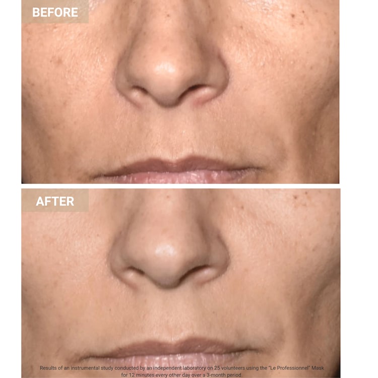 The Professional  - Máscara facial led antiedad
