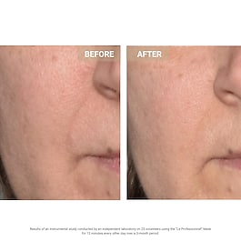  \The Professional\  - Masque LED anti-age visage 