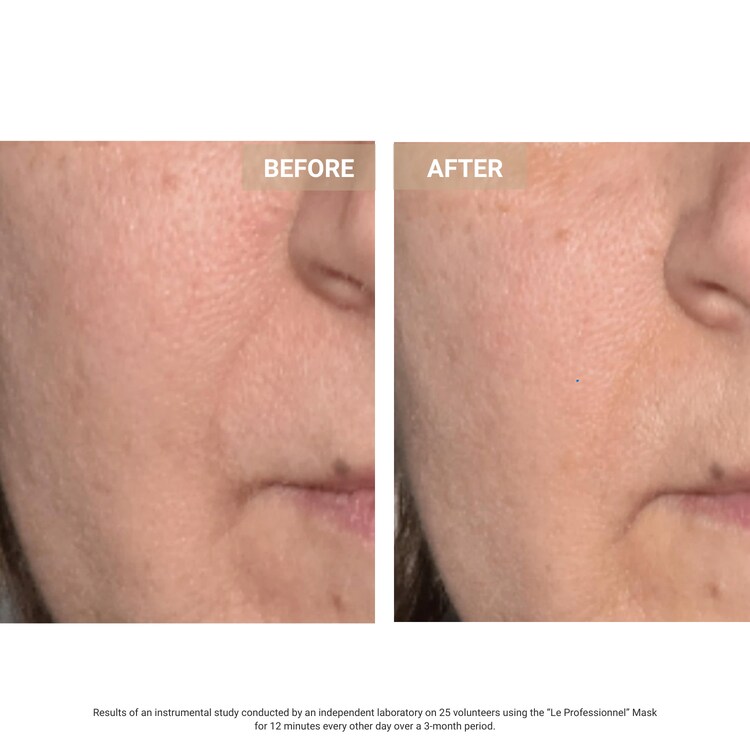The Professional  - Máscara facial led antiedad