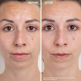 Anti-Redness Clarifying Care - Sérum anti-rougeur & anti-imperfections  