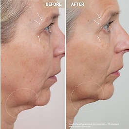 Youth Serum - Bakır peptitleri i&ccedil;eren yaşlanma karşıtı serum