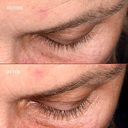 Lashbond™ - Siero Per Ciglia
