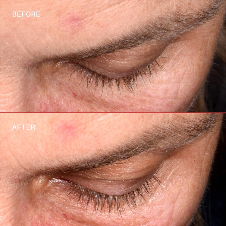 Lashbond™ - Ögonfransserum