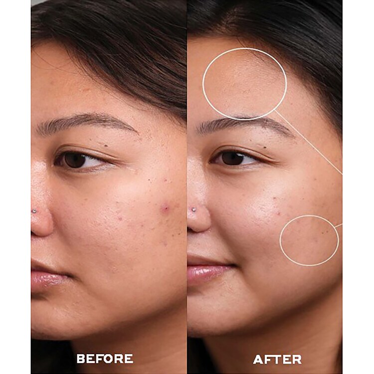 Dewtopia 20% Acid Night Treatment - Siero notte antietà & macchie con AHA + PHA