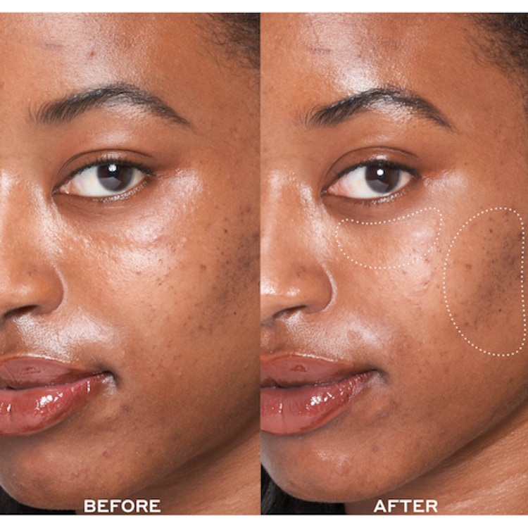 Dewtopia 25% Acid Flash Facial - Masque exfoliant visage