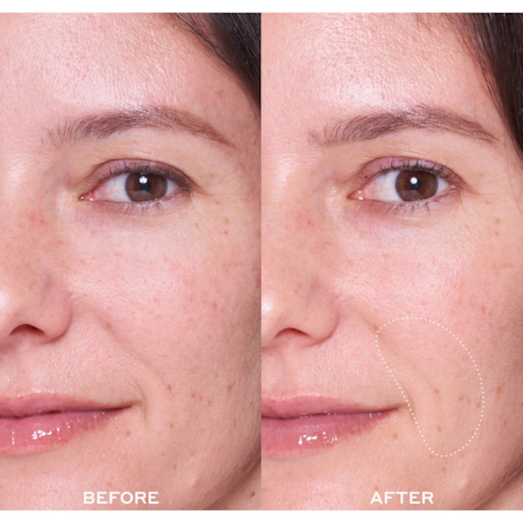 Dewtopia 25% Acid Flash Facial - Masque exfoliant visage