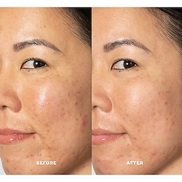 Glow 2OH Dark Spot Toner - Gesichtswasser für dunkle Flecken mit AHA