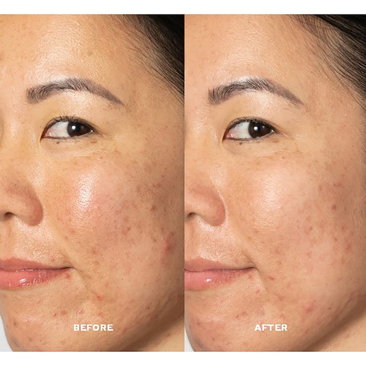 Glow2OH™ - Dark Spot Toner