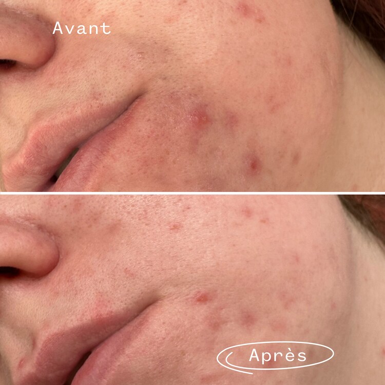 PHAZE - Gel de curatare