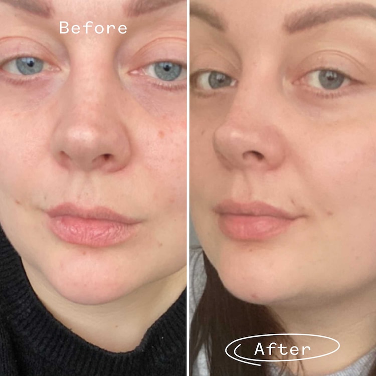 Huile De Rosier Sauvage Bioregenerate