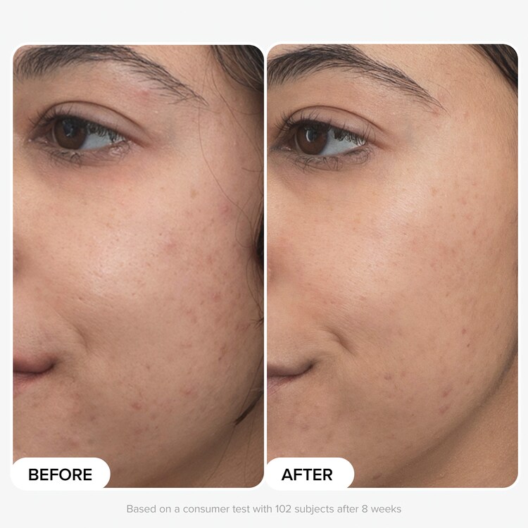 Clinical - Sérum Rétinaldéhyde duo PRO